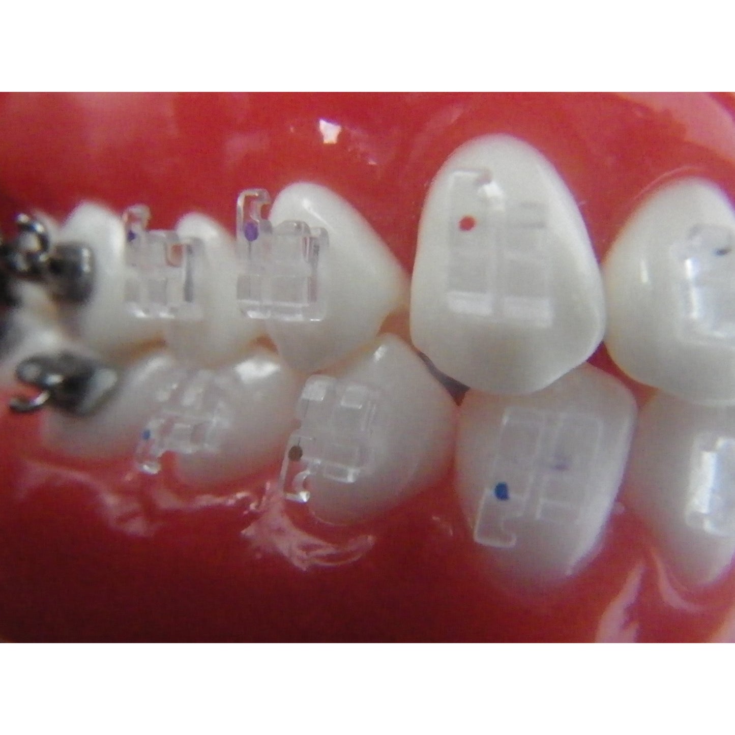 Cx Clear Individual Monocrystalline Brackets- MBT .018 (set of 5)