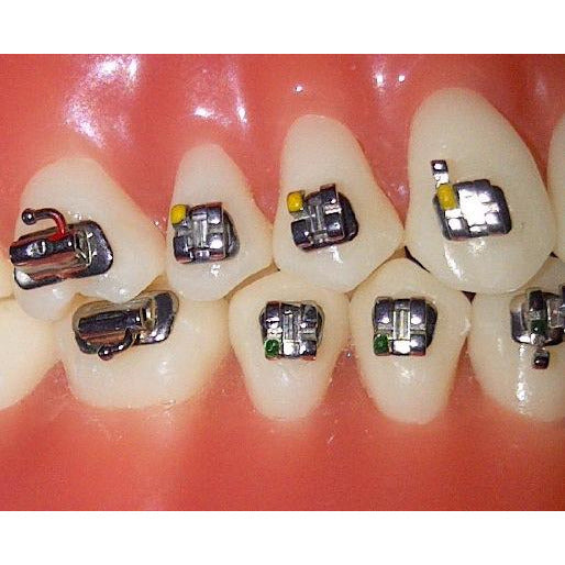 Cx Plus Roth .022 Mesh SS Brackets Hooks 3's (Full Set U/L 5-5!)