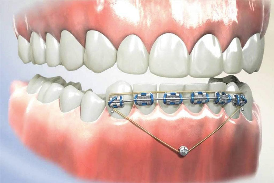 Things I Don't Use, Things I Don't Do.