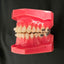 CX Ceramic .018 Roth Brackets Hooks 3,4,5's