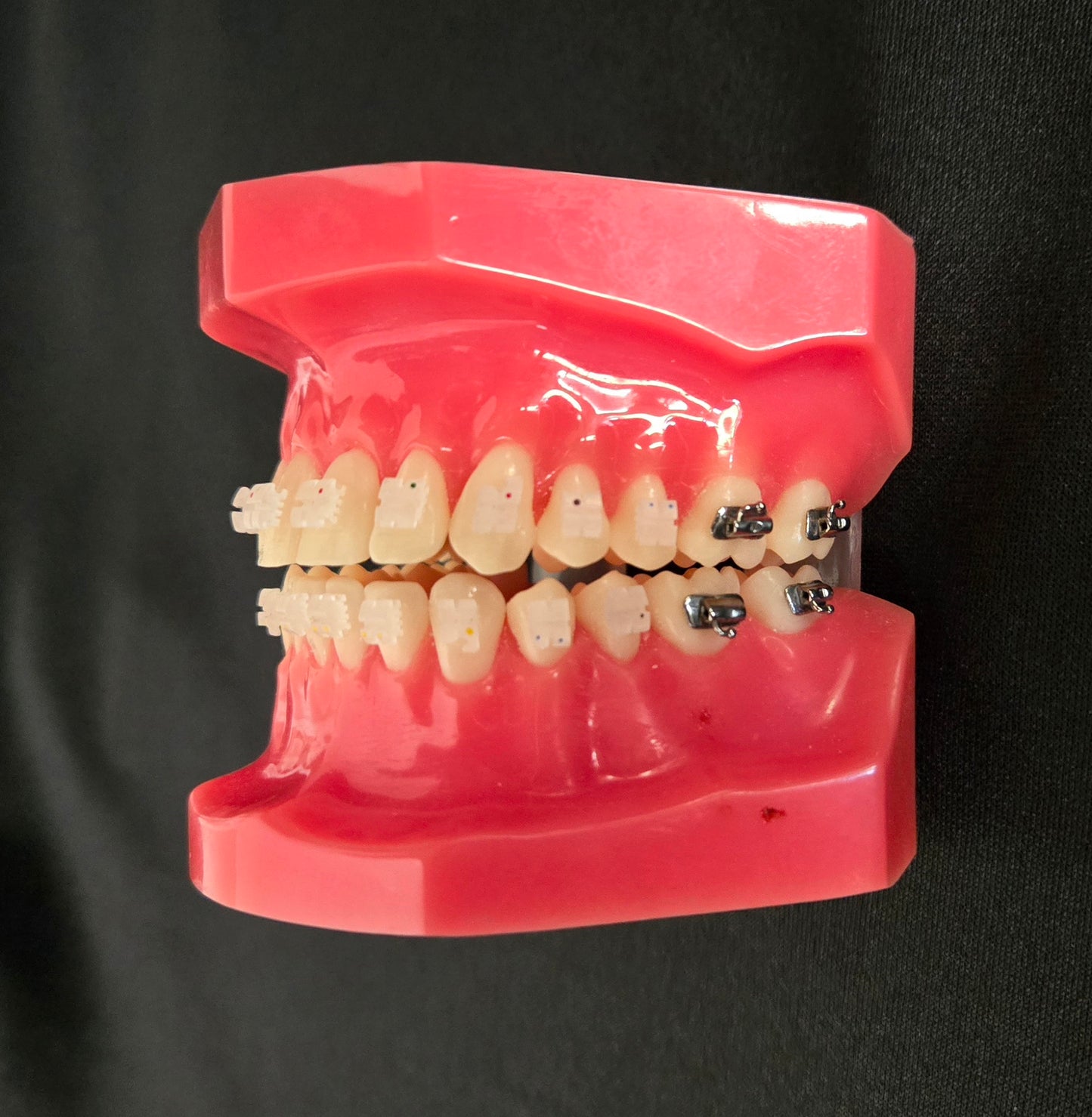CX Ceramic .018 Roth Brackets Hooks 3,4,5's