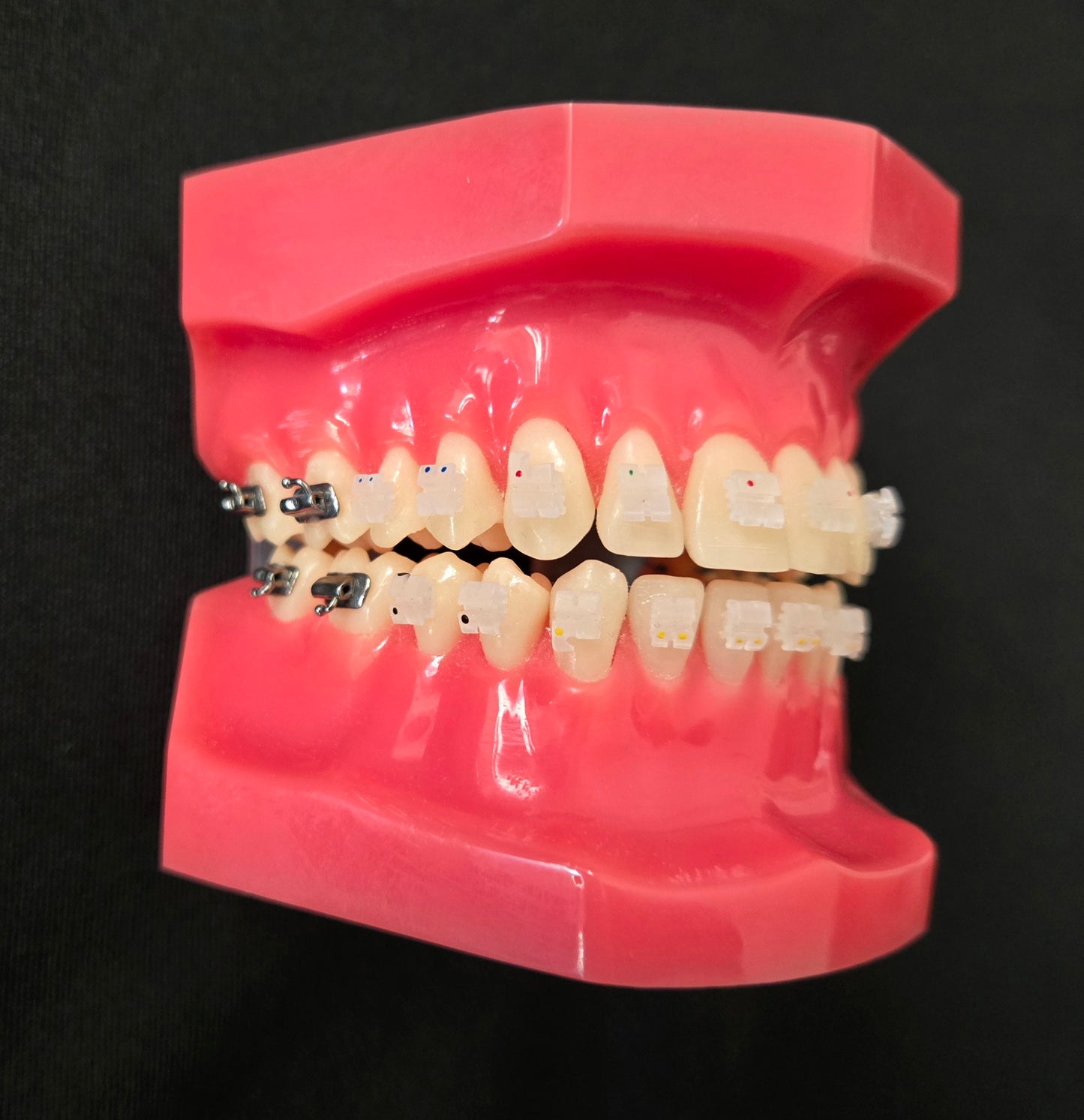 CX Ceramic .018 Roth Brackets Hooks 3,4,5's